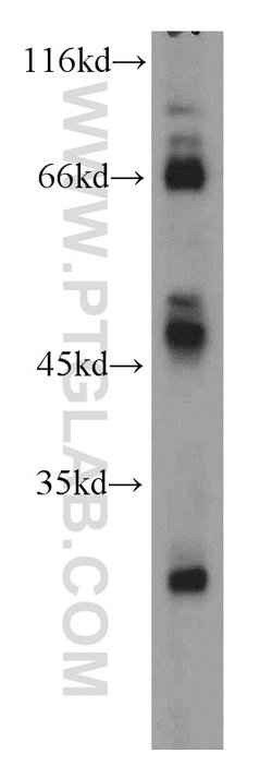 CD1a Rabbit anti-Human, Mouse, Polyclonal, Proteintech 150 &mu;L; Unconjugated:Antibodies,