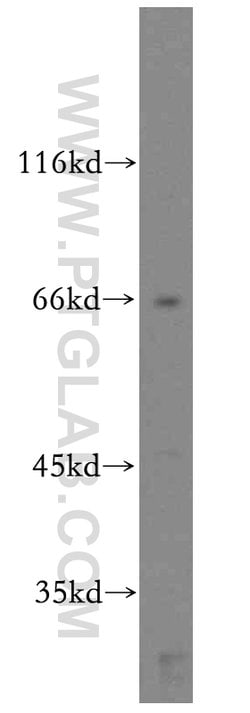 CD1a Rabbit anti-Human, Mouse, Polyclonal, Proteintech 150 &mu;L; Unconjugated:Antibodies,