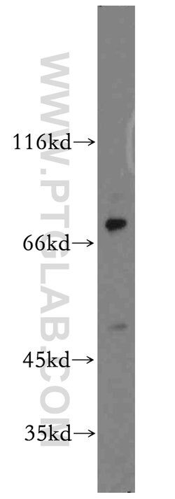CD1a Rabbit anti-Human, Mouse, Polyclonal, Proteintech 150 &mu;L; Unconjugated:Antibodies,