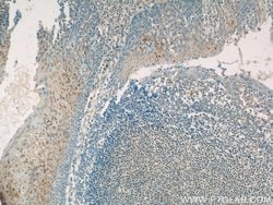 GSG1L Rabbit anti-Human, Polyclonal, Proteintech:Antibodies:Primary Antibodies