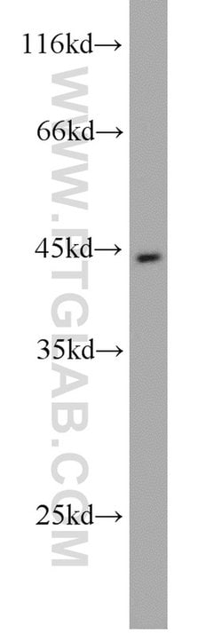 Pepsinogen I Rabbit anti-Human, Mouse, Rat, Polyclonal, Proteintech 150