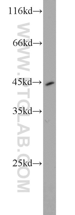 Pepsinogen I Rabbit anti-Human, Mouse, Rat, Polyclonal, Proteintech 150