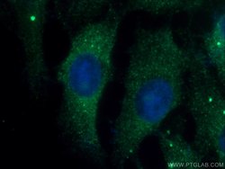 JNK2 Rabbit anti-Human, Mouse, Rat, Polyclonal, Proteintech 150 &mu;L;