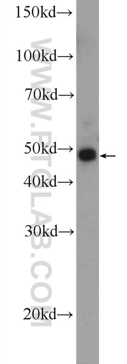 JNK2 Rabbit anti-Human, Mouse, Rat, Polyclonal, Proteintech 150 &mu;L;