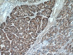 MEK4 Rabbit anti-Human, Mouse, Rat, Polyclonal, Proteintech:Antibodies:Primary
