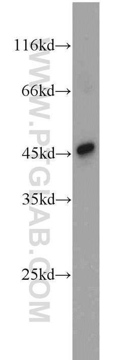 MEK4 Rabbit anti-Human, Mouse, Rat, Polyclonal, Proteintech:Antibodies:Primary