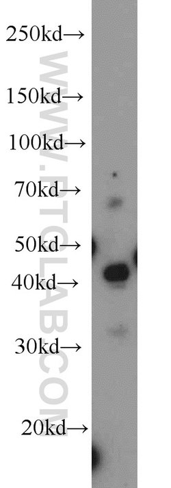 MEK4 Rabbit anti-Human, Mouse, Rat, Polyclonal, Proteintech:Antibodies:Primary
