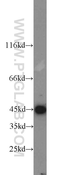 MEK4 Rabbit anti-Human, Mouse, Rat, Polyclonal, Proteintech:Antibodies:Primary