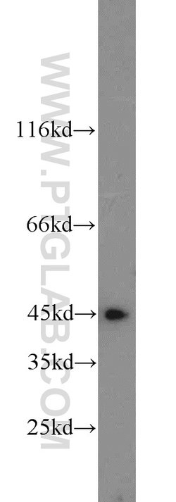 MEK4 Rabbit anti-Human, Mouse, Rat, Polyclonal, Proteintech:Antibodies:Primary