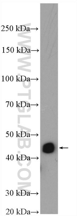 MEK4 Rabbit anti-Human, Mouse, Rat, Polyclonal, Proteintech:Antibodies:Primary