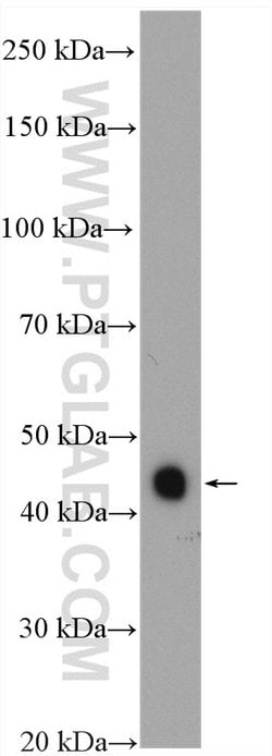 MEK4 Rabbit anti-Human, Mouse, Rat, Polyclonal, Proteintech:Antibodies:Primary