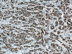 MEK4 Rabbit anti-Human, Mouse, Rat, Polyclonal, Proteintech:Antibodies:Primary