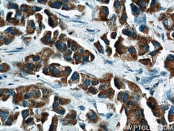 MEK4 Rabbit anti-Human, Mouse, Rat, Polyclonal, Proteintech:Antibodies:Primary