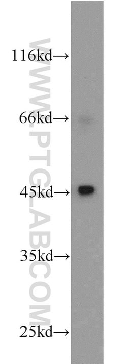 MEK4 Rabbit anti-Human, Mouse, Rat, Polyclonal, Proteintech:Antibodies:Primary