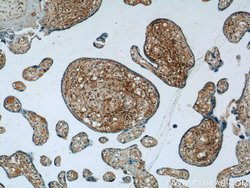 PLAC1L Rabbit anti-Human, Mouse, Rat, Polyclonal, Proteintech:Antibodies:Primary
