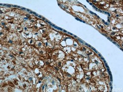 PLAC1L Rabbit anti-Human, Mouse, Rat, Polyclonal, Proteintech:Antibodies:Primary