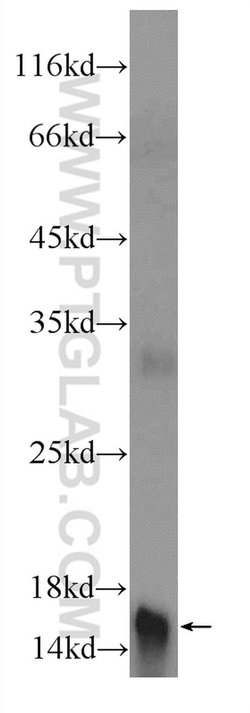PLAC1L Rabbit anti-Human, Mouse, Rat, Polyclonal, Proteintech:Antibodies:Primary