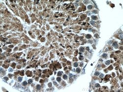 ACTL7A Rabbit anti-Human, Mouse, Rat, Polyclonal, Proteintech 20 &mu;L | Buy Online | Proteintech | Fisher Scientific