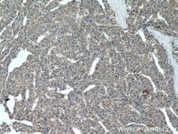 CHDH Rabbit anti-Human, Mouse, Rat, Polyclonal, Proteintech 150 &mu;L;