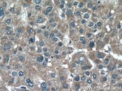 CHDH Rabbit anti-Human, Mouse, Rat, Polyclonal, Proteintech 150 &mu;L;
