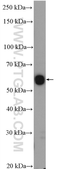 CHDH Rabbit anti-Human, Mouse, Rat, Polyclonal, Proteintech 150 &mu;L;