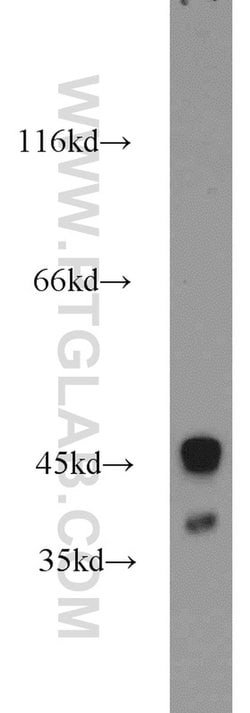 ZnT3 Rabbit anti-Human, Mouse, Rat, Polyclonal, Proteintech 20 &mu;L; Unconjugated:Antikörper