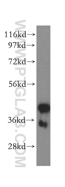 ZnT3 Rabbit anti-Human, Mouse, Rat, Polyclonal, Proteintech 20 &mu;L; Unconjugated:Antikörper