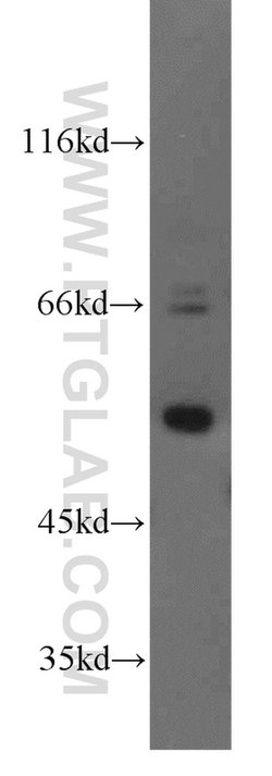 TADA2B Rabbit anti-Human, Polyclonal, Proteintech:Antibodies:Primary Antibodies