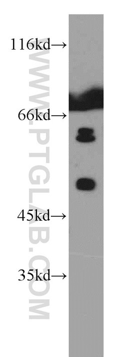TADA2B Rabbit anti-Human, Polyclonal, Proteintech:Antibodies:Primary Antibodies