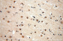 TEX10 Rabbit anti-Human, Mouse, Rat, Polyclonal, Proteintech 150 &mu;L;