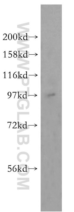 TEX10 Rabbit anti-Human, Mouse, Rat, Polyclonal, Proteintech 150 &mu;L;