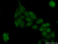 TEX10 Rabbit anti-Human, Mouse, Rat, Polyclonal, Proteintech 150 &mu;L;