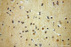 TEX10 Rabbit anti-Human, Mouse, Rat, Polyclonal, Proteintech 150 &mu;L;