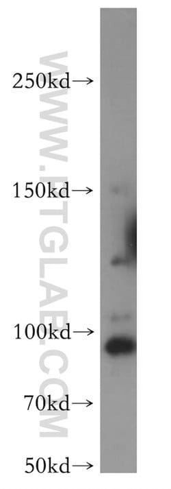 TEX10 Rabbit anti-Human, Mouse, Rat, Polyclonal, Proteintech 150 &mu;L;