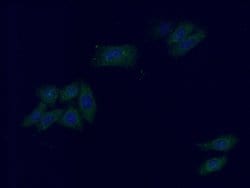 ALDH1L1 Rabbit anti-Human, Mouse, Rat, Polyclonal, Proteintech:Antibodies:Primary