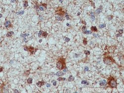 ALDH1L1 Rabbit anti-Human, Mouse, Rat, Polyclonal, Proteintech:Antibodies:Primary