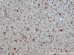 ALDH1L1 Rabbit anti-Human, Mouse, Rat, Polyclonal, Proteintech:Antibodies:Primary
