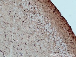 ALDH1L1 Rabbit anti-Human, Mouse, Rat, Polyclonal, Proteintech:Antibodies:Primary