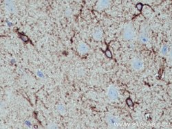 ALDH1L1 Rabbit anti-Human, Mouse, Rat, Polyclonal, Proteintech:Antibodies:Primary