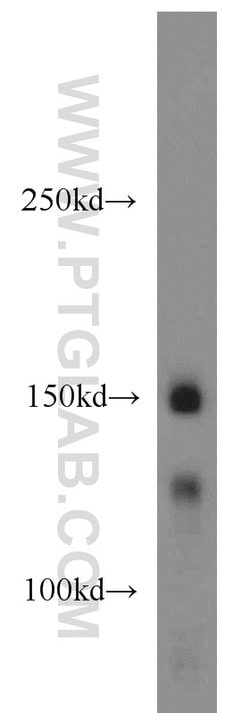 PRPF40A Rabbit anti-Human, Mouse, Polyclonal, Proteintech 150 &mu;L; Unconjugated:Antibodies,
