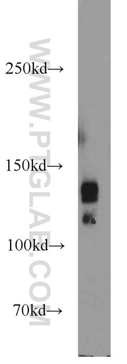 PRPF40A Rabbit anti-Human, Mouse, Polyclonal, Proteintech 150 &mu;L; Unconjugated:Antibodies,