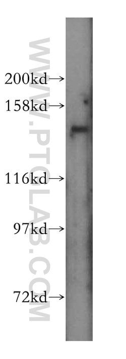 SLC9A11 Rabbit anti-Human, Mouse, Rat, Polyclonal, Proteintech:Antibodies:Primary