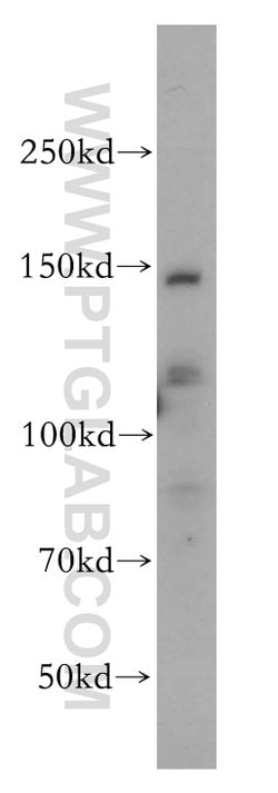 SLC9A11 Rabbit anti-Human, Mouse, Rat, Polyclonal, Proteintech:Antibodies:Primary