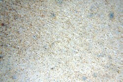 Peripherin Rabbit anti-Human, Mouse, Rat, Polyclonal, Proteintech:Antibodies:Primary