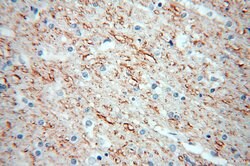 Peripherin Rabbit anti-Human, Mouse, Rat, Polyclonal, Proteintech:Antibodies:Primary