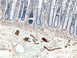 Peripherin Rabbit anti-Human, Mouse, Rat, Polyclonal, Proteintech:Antibodies:Primary