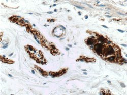 Peripherin Rabbit anti-Human, Mouse, Rat, Polyclonal, Proteintech:Antibodies:Primary