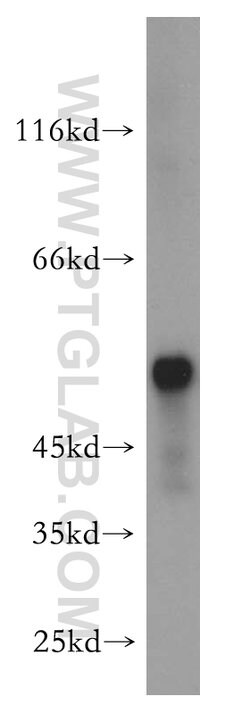 Peripherin Rabbit anti-Human, Mouse, Rat, Polyclonal, Proteintech:Antibodies:Primary