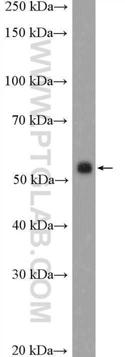 Peripherin Rabbit anti-Human, Mouse, Rat, Polyclonal, Proteintech:Antibodies:Primary