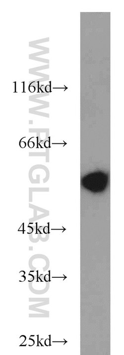 Peripherin Rabbit anti-Human, Mouse, Rat, Polyclonal, Proteintech:Antibodies:Primary
